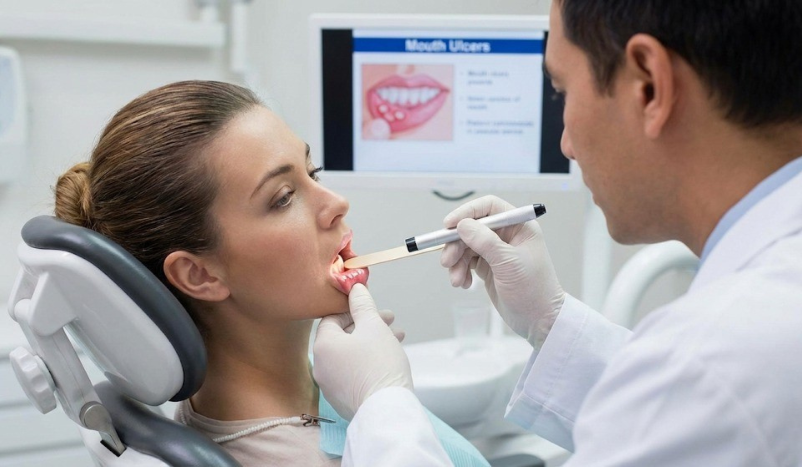 Mouth Ulcers